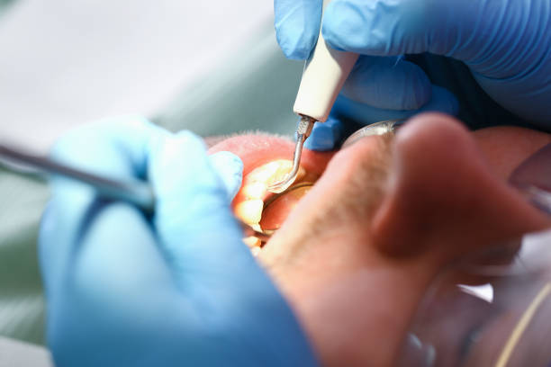 Best Emergency Tooth Extraction in Leesport, PA